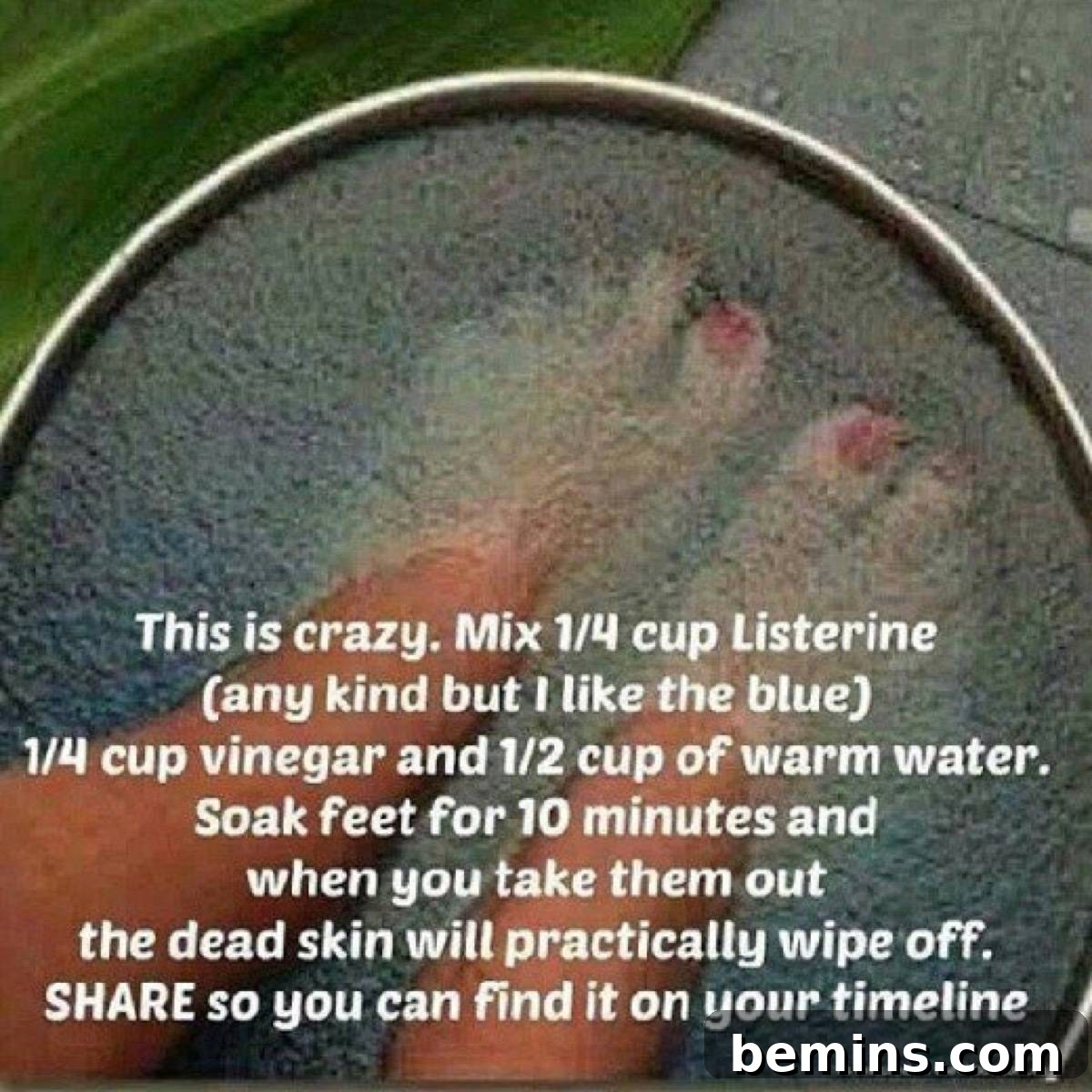 Do Pinterest Beauty Hacks Really Deliver? 20 Listerine foot soak