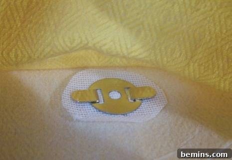 Securing the magnetic snap in place